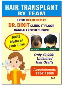 Hair-Transplant-From-Delhi-NCR-at-Dr-Dixit-Clinic-100%-Natural-Hair-line